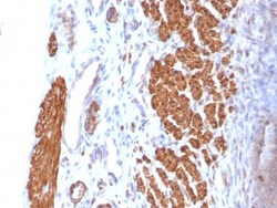 Calponin 1 Antibody (CNN1/832), Novus Biologicals 0.2mg; Unlabeled:Antibodies,